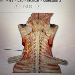 Identify the highlighted structure nervous system