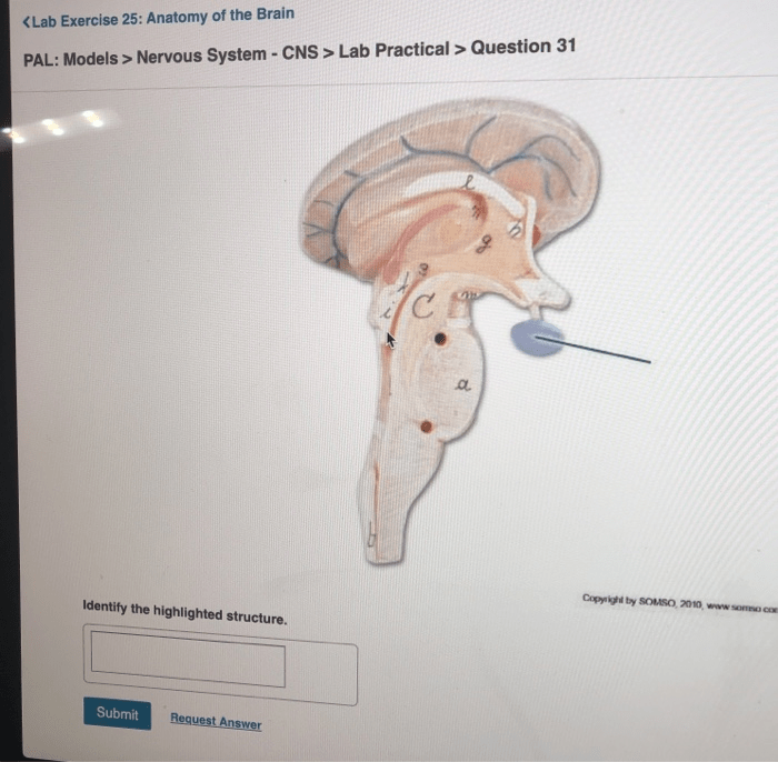 Identify the highlighted structure nervous system