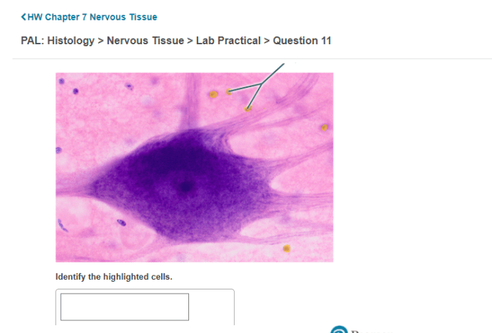 Identify the highlighted structure nervous system